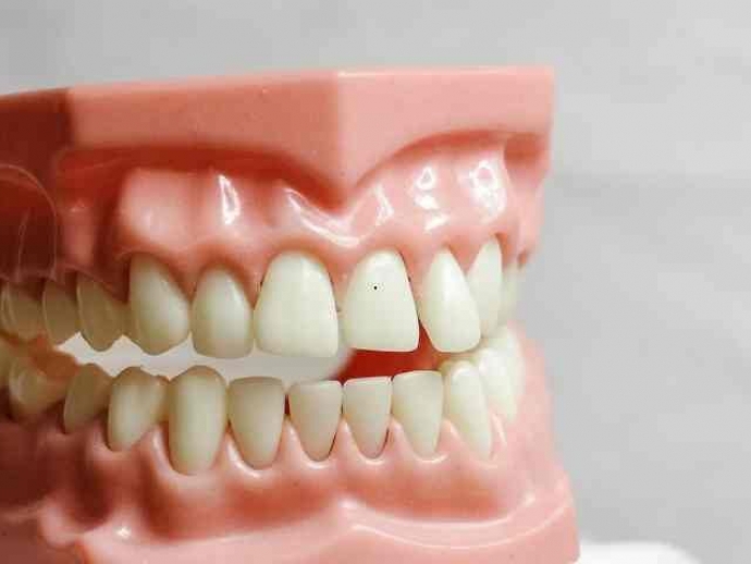 How to Save on Dental Care: Local Dental Coupons Blogging Tips